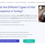 The Latest Trend of Hair Transplants in Turkey 2022