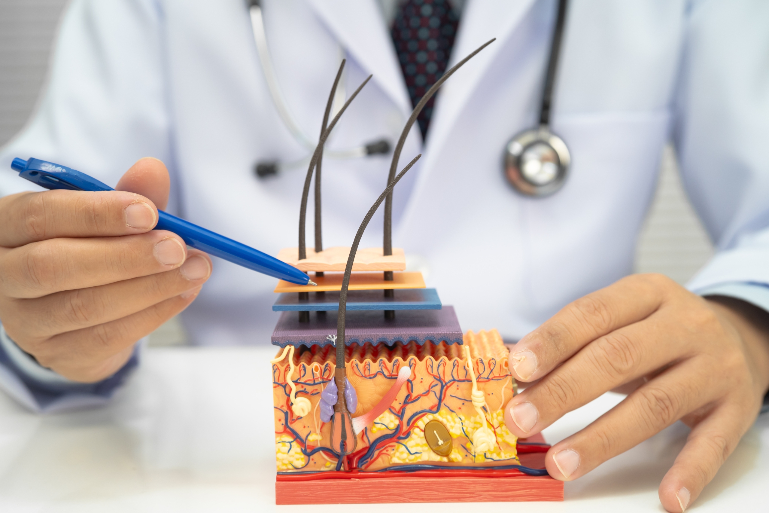 How Much Does Hair Transplant in Trkiye Cost?